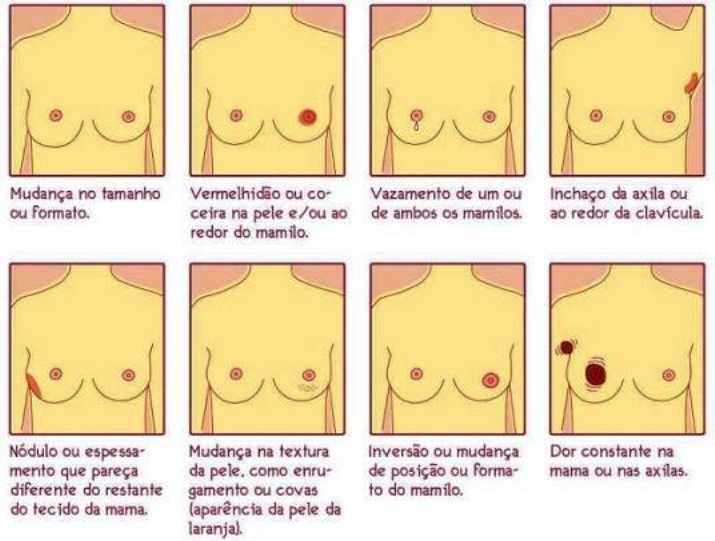 Outubro Rosa